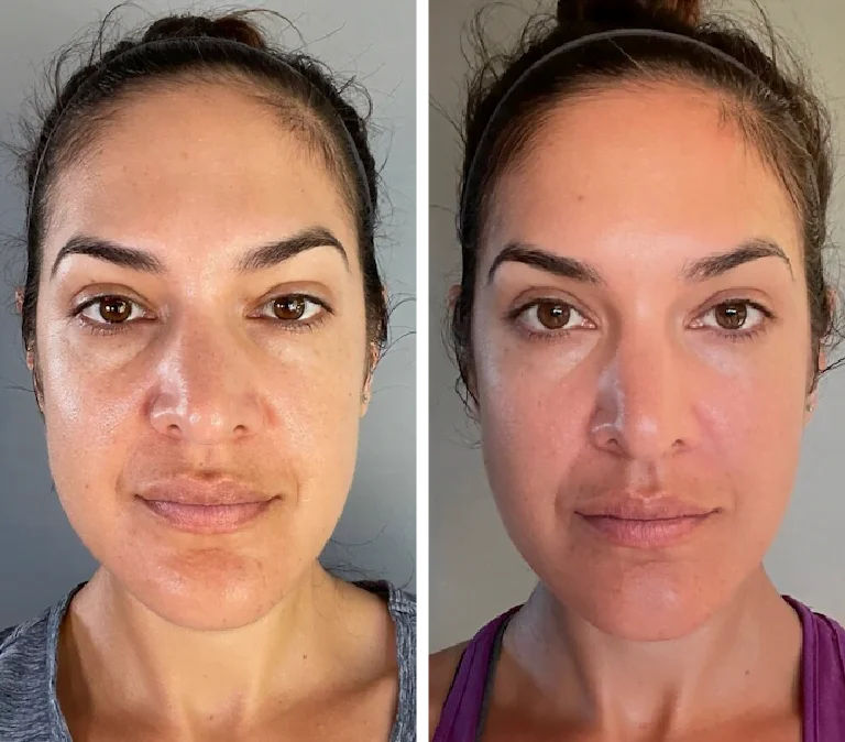 Gua Sha tools
