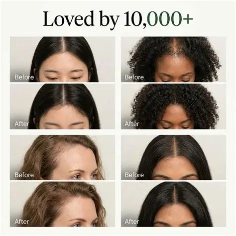 Korean Scalp Care Bar